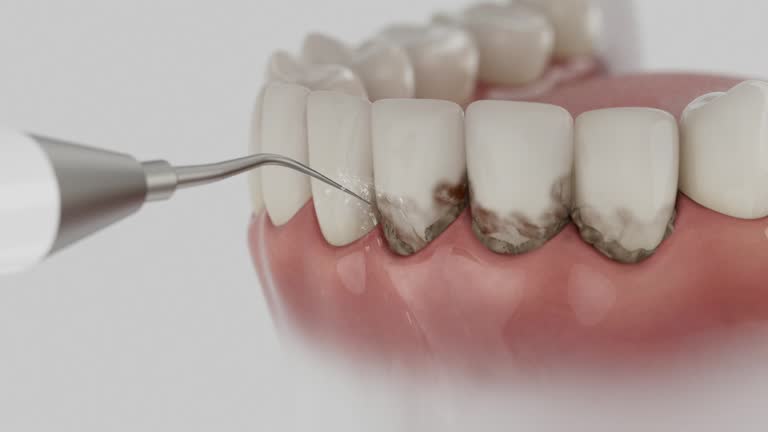 Reliable Emergency Dentist contractor in Springfield, MO by Smile Center Dentistry